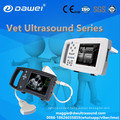 DW-600 pocket sized digital ultrasound machine for gynecology